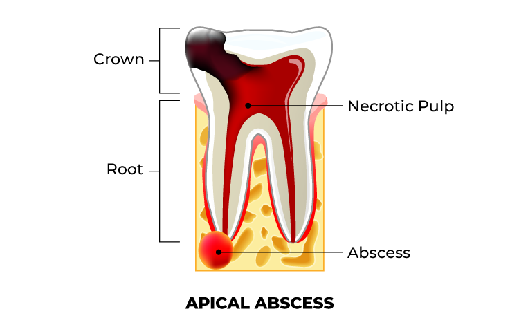 Tooth graphic - Capital Endodontics