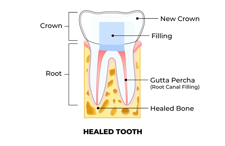 Tooth graphic - Capital Endodontics